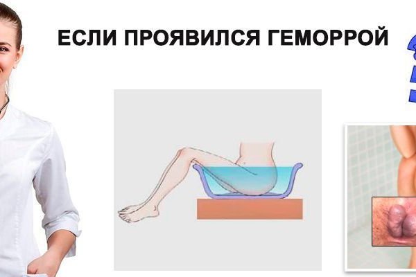 Кракен даркнет не работает